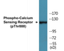 Western blot analysis of extracts from LOVO cells, using Calcium Sensing Receptor (Phospho-Thr888) Antibody. 