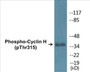 Western blot analysis of extracts from HepG2 cells, Jurkat cells, HuvEc cells and A549 cells, using Cyclin H (Phospho-Thr315) Antibody.