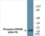 Western blot analysis of extracts from HepG2 cells treated with nocodazole 1ug/ml 16h, using CRYAB (Phospho-Ser19) Antibody.