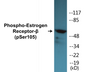 Western blot analysis of extracts from HeLa cells, using Estrogen Receptor-beta (Phospho-Ser105) Antibody.