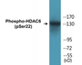 Western blot analysis of extracts from NIH-3T3 cells treated with Anisomycin 25ug/ml 30', using HDAC6 (Phospho-Ser22) Antibody. 