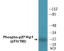 Western blot analysis of extracts from HeLa cells, HepG2 cells and COLO cells, using p27 Kip1 (Phospho-Thr198) Antibody.