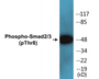 Western blot analysis of extracts from RAW264.7 cells, using Smad2/3 (Phospho-Thr8) Antibody.
