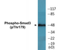 Western blot analysis of extracts from HeLa cells treated with TNF 20ng/ml 2', using Smad3 (Phospho-Thr179) Antibody.