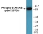Western blot analysis of extracts from Jurkat cells treated with EGF 200ng/ml 30', using STAT5A/B (Phospho-Ser725/730) Antibody.