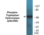Western blot analysis of extracts from Jurkat cells and HepG2 cells, using Tryptophan Hydroxylase (Phospho-Ser260) Antibody.
