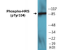 Western blot analysis of extracts from HepG2 cells treated with PMA 125ng/ml 30', using HRS (Phospho-Tyr334) Antibody.