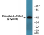 Western blot analysis of extracts from HuvEc cells treated with serum 20% 15', using IL-13R alpha1 (Phospho-Tyr405) Antibody.