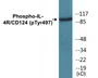 Western blot analysis of extracts from 293 cells, using IL-4R/CD124 (Phospho-Tyr497) Antibody.