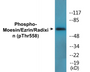 Western blot analysis of extracts from NIH-3T3 cells, using Moesin/Ezrin/Radixin (Phospho-Thr558) Antibody.