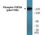 Western blot analysis of extracts from Jurkat cells treated with paclitaxel 1uM 24h, using TOP2A (Phospho-Ser1106) Antibody.