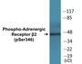 Western blot analysis of extracts from HepG2 cells treated with nocodazole 1ug/ml 16h, using Adrenergic Receptor beta2 (Phospho-Ser346) Antibody.