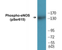 Western blot analysis of extracts from K562 cells treated with EGF 40nM 30', using eNOS (Phospho-Ser615) Antibody.