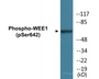 Western blot analysis of extracts from 293 cells treated with etoposide 25uM 60', using WEE1 (Phospho-Ser642) Antibody.