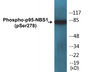Western blot analysis of extracts from HuvEc cells treated with Forskolin 40nM 30', using Nibrin (Phospho-Ser278) Antibody.