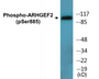 Western blot analysis of extracts from HeLa cells treated with TSA 400nM 24H and Jurkat cells treated with forskolin 40nM 30', using Rho/Rac Guanine Nucleotide Exchange Factor 2 (Phospho-Ser885) Antibody.