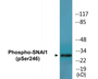 Western blot analysis of extracts from HT29 cells, using SNAI1 (Phospho-Ser246) Antibody.