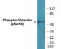 Western blot analysis of extracts from A549 cells treated with Nocodazole 1ug/ml 16h, using Vimentin (Phospho-Ser56) Antibody.