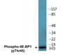 Western blot analysis of extracts from MDA-MB-435 cells treated with EGF 200ng/ml 5', using 4E-BP1 (Phospho-Thr45) Antibody.