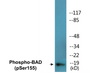 Western blot analysis of extracts from 293 cells treated with Forskolin, using BAD (Phospho-Ser155) Antibody.