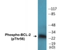 Western blot analysis of extracts from K562 cells treated with H2O2 100uM 30', using BCL-2 (Phospho-Thr56) Antibody.