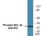 Western blot analysis of extracts from 293 cells treated with UV and MDA-MB-435 cells treated with UV, using BCL-XL (Phospho-Ser62) Antibody.
