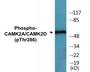 Western blot analysis of extracts from K562 cells, using CaMK2 (Phospho-Thr286) Antibody.