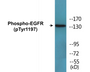 Western blot analysis of extracts from A431 cells treated with EGF 40 muM 10', using EGFR (Phospho-Tyr1197) Antibody.