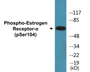 Western blot analysis of extracts from 293 cells, using Estrogen Receptor-alpha (Phospho-Ser104) Antibody.