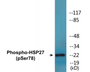 Western blot analysis of extracts from HeLa cells treated with Ca2+, using HSP27 (Phospho-Ser78) Antibody.