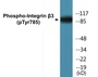 Western blot analysis of extracts from HeLa cells, HepG2 cells and HuvEc cells, using Integrin beta3 (Phospho-Tyr785) Antibody.