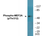 Western blot analysis of extracts from NIH-3T3 cells treated with PMA, using MEF2A (Phospho-Thr312) Antibody.