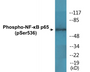 Western blot analysis of extracts from K562 cells and COLO cells, using NF-kappaB p65 (Phospho-Ser536) Antibody.