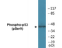 Western blot analysis of extracts from LOVO cells, using p53 (Phospho-Ser9) Antibody.