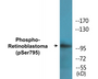 Western blot analysis of extracts from K562 cells treated with serum 10%, using Retinoblastoma (Phospho-Ser795) Antibody.