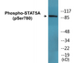 Western blot analysis of extracts from HeLa cells, using STAT5A (Phospho-Ser780) Antibody.