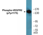 Western blot analysis of extracts from HuvEc cells and NIH/3T3 cells, using VEGFR2 (Phospho-Tyr1175) Antibody.