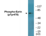 Western blot analysis of extracts from K562 cells treated with Na3VO4 0.3nM 40', using Ezrin (Phospho-Tyr478) Antibody.