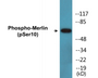 Western blot analysis of extracts from NIH-3T3 cells treated with IFN 2500U/ml 30', using Merlin (Phospho-Ser10) Antibody.