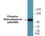 Western blot analysis of extracts from Jurkat cells treated with PMA 125ng/ml 30', using Retinoblastoma (Phospho-Ser608) Antibody.