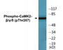 Western blot analysis of extracts from rat brain, using CaMK2-beta/gamma/delta (Phospho-Thr287) Antibody.