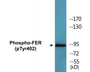 Western blot analysis of extracts from Jurkat cells treated with starved 24h, using FER (Phospho-Tyr402) Antibody.