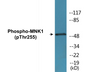 Western blot analysis of extracts from HeLa cells treated with Adriamycin 0.5ug/ml 24h, using MNK1 (Phospho-Thr255) Antibody.