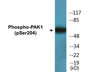 Western blot analysis of extracts from NIH-3T3 cells treated with UV 15', using PAK1 (Phospho-Ser204) Antibody.