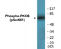 Western blot analysis of extracts from HeLa cells treated with heat shock, using PKCB (Phospho-Ser661) Antibody.