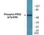 Western blot analysis of extracts from COS7 cells , using FRS2 (Phospho-Tyr436) Antibody.
