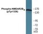 Western blot analysis of extracts from Jurkat cells treated with TNF 20ng/ml 30', using NMDAR2B (Phospho-Tyr1336) Antibody.