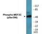 Western blot analysis of extracts from NIH-3T3 cells treated with starved 24h, using MEF2C (Phospho-Ser396) Antibody.