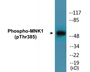 Western blot analysis of extracts from COLO205 cells treated with PMA 125ng/ml 30', using Mnk1 (Phospho-Thr385) Antibody.