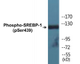 Western blot analysis of extracts from Jurkat cells treated with TNF 20ng/ml 30', using SREBP-1 (Phospho-Ser439) Antibody.